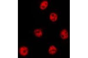 Immunofluorescence (fixed cells) (IF/ICC) image for anti-Cleavage Stimulation Factor, 3' Pre-RNA, Subunit 2, 64kDa, tau Variant (CSTF2T) (N-Term) antibody (ABIN6258757)