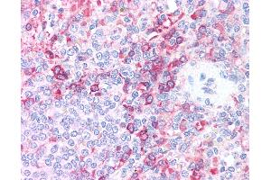 Anti-AURKB / Aurora-B antibody IHC of human spleen. (Aurora Kinase B 抗体  (AA 227-238))