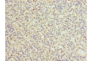 Immunohistochemistry of paraffin-embedded human spleen tissue using ABIN7147031 at dilution of 1:100 (CATSPER2 抗体  (AA 5-112))