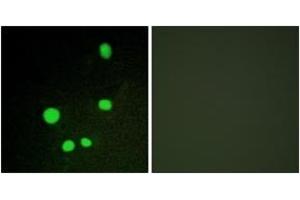 Immunofluorescence analysis of COS7 cells, using MED14 Antibody. (MED14 抗体  (AA 701-750))