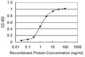 Detection limit for recombinant GST tagged LMTK3 is 0. (LMTK3 抗体  (AA 1151-1250))