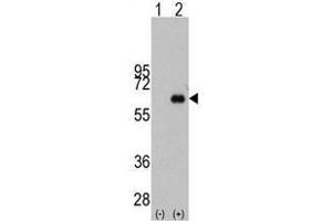 Image no. 1 for anti-Myc Proto-Oncogene protein (MYC) antibody (ABIN357363) (c-MYC 抗体)