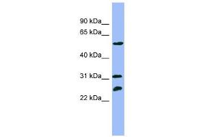 PSMC4 antibody used at 1 ug/ml to detect target protein. (PSMC4 抗体)