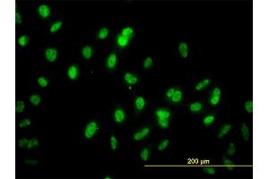 Immunofluorescence of monoclonal antibody to GABPA on HeLa cell. (GABPA 抗体  (AA 1-100))