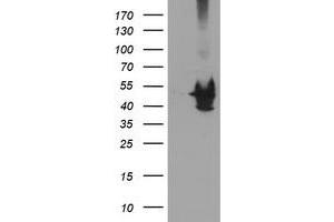 Western Blotting (WB) image for anti-Potassium Voltage-Gated Channel, Shaker-Related Subfamily, beta Member 1 (KCNAB1) antibody (ABIN1499001) (KCNAB1 抗体)