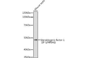 Western blot analysis of extracts of Mouse testis, using Steroidogenic factor-1 (SF-1/NR5) antibody (657) at 1:1000 dilution. (NR5A1 抗体  (AA 1-120))