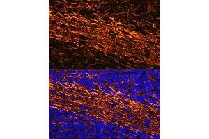 Immunofluorescence (IF) image for anti-Neurofilament, Light Polypeptide (NEFL) (AA 400-543) antibody (ABIN3020809)