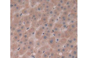 Used in DAB staining on fromalin fixed paraffin- embedded Kidney tissue (Complement Factor I 抗体  (AA 28-243))