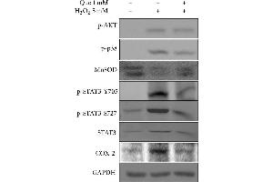 Effects of quercetin on the inflammatory response in H2O2-treated H9C2 cells. (PTGS2 抗体  (C-Term))