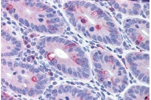 Mouse small intestine: Formalin-Fixed, Paraffin-Embedded (FFPE) (IFIH1 抗体  (C-Term))