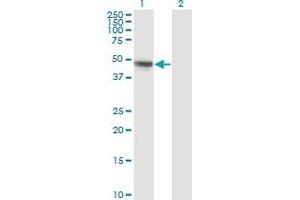 Western Blot analysis of CBLC expression in transfected 293T cell line by CBLC monoclonal antibody (M01), clone 3F10. (CBLC 抗体  (AA 1-474))
