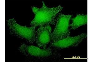 Immunofluorescence of monoclonal antibody to SMG1 on HeLa cell. (SMG1 抗体  (AA 2922-3031))