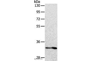 Western blot analysis of Human fetal intestine tissue, using IL1RL1 Polyclonal Antibody at dilution of 1:700 (IL1RL1 抗体)