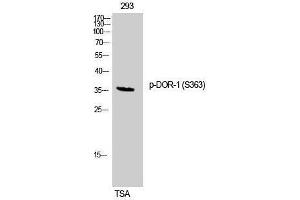 Western Blotting (WB) image for anti-Opioid Receptor, delta 1 (OPRD1) (pSer363) antibody (ABIN3182512) (OPRD1 抗体  (pSer363))