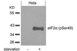 Image no. 3 for anti-Eukaryotic Translation Initiation Factor 2 Subunit 1 (EIF2S1) (pSer49) antibody (ABIN319275) (EIF2S1 抗体  (pSer49))