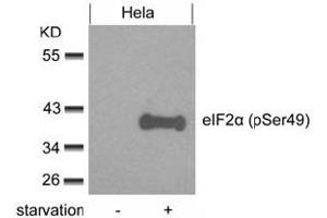 Image no. 3 for anti-Eukaryotic Translation Initiation Factor 2 Subunit 1 (EIF2S1) (pSer49) antibody (ABIN319276) (EIF2S1 抗体  (pSer49))