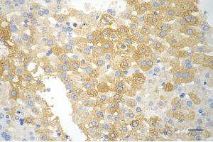 Immunohistochemistry was performed on paraffin-embedded mouse liver using phospho-ACC(S79) antibody (ABIN7797443), 1:200).