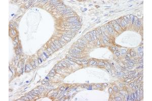 anti-KIAA1524 (KIAA1524) (AA 550-600) antibody