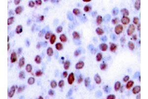 Image no. 1 for anti-Jun Proto-Oncogene (JUN) antibody (ABIN265353) (C-JUN 抗体)