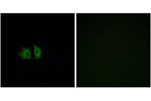 Immunofluorescence analysis of A549 cells, using FZD5 Antibody. (FZD5 抗体  (AA 461-510))