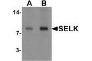 Western blot analysis of SELK in A20 cell lysate with SELK antibody at (A) 1 and (B) 2 μg/ml.
