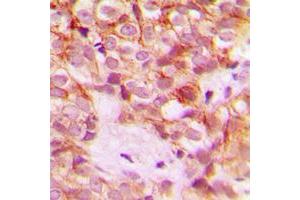 Immunohistochemistry (IHC) image for anti-Collagen, Type I, alpha 2 (COL1A2) (Center) antibody (ABIN7295318)