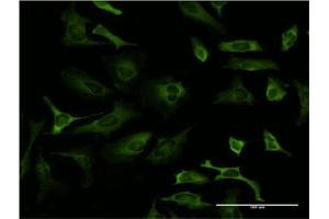 Immunofluorescence (IF) image for anti-Poly(rC) Binding Protein 2 (PCBP2) (AA 1-362) antibody (ABIN518658)