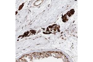 Immunohistochemical staining of human testis with LRRC56 polyclonal antibody  shows strong cytoplasmic positivity in Leydig cells at 1:200-1:500 dilution. (LRRC56 抗体)