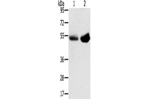 Western Blotting (WB) image for anti-Solute Carrier Family 13 Member 3 (SLC13A3) antibody (ABIN2427263)