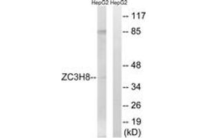 Western Blotting (WB) image for anti-Zinc Finger CCCH-Type Containing 8 (ZC3H8) (AA 81-130) antibody (ABIN2879217) (ZC3H8 抗体  (AA 81-130))