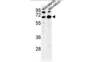 Western blot analysis of BEST2 Antibody (C-term) in MDA-MB435,MDA-MB231 cell line lysates (35µg/lane). (Bestrophin 2 抗体  (C-Term))