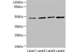 Western blot All lanes: TTC5 antibody at 6 μg/mL Lane 1: HepG2 whole cell lysate Lane 2: A549 whole cell lysate Lane 3: MCF-7 whole cell lysate Lane 4: Mouse kidney tissue Secondary Goat polyclonal to rabbit IgG at 1/10000 dilution Predicted band size: 49 kDa Observed band size: 49 kDa (TTC5 抗体  (AA 201-440))