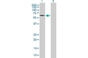 Western Blot analysis of GDPD2 expression in transfected 293T cell line by GDPD2 MaxPab polyclonal antibody. (GDPD2 抗体  (AA 1-539))