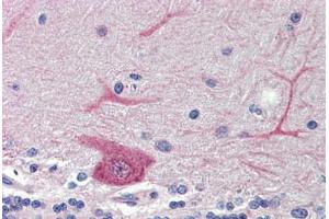 Brain, cerebellum, Human: Formalin-Fixed, Paraffin-Embedded (FFPE) (GABARAPL1 抗体  (N-Term))