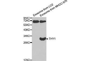 Western blot analysis of extracts of exosome from various cell lines, using THY1 antibody. (CD90 抗体  (AA 20-130))