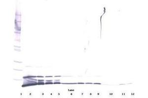 Image no. 2 for anti-Chemokine (C-X-C Motif) Ligand 1 (Melanoma Growth Stimulating Activity, Alpha) (CXCL1) antibody (ABIN464980)