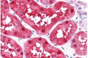 Human Kidney: Formalin-Fixed, Paraffin-Embedded (FFPE) (FABP1 抗体  (N-Term))
