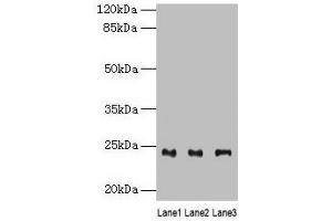 Western blot All lanes: RAB4B antibody at 4 μg/mL Lane 1: Mouse stomach tissue Lane 2: Mouse kidney tissue Lane 3: Mouse gonadal tissue Secondary Goat polyclonal to rabbit IgG at 1/10000 dilution Predicted band size: 24, 28 kDa Observed band size: 24 kDa (RAB4B 抗体  (AA 2-213))