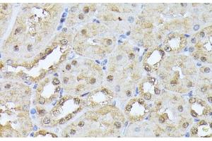 Immunohistochemistry of paraffin-embedded Mouse kidney using PSMB3 Polyclonal Antibody at dilution of 1:100 (40x lens). (PSMB3 抗体)