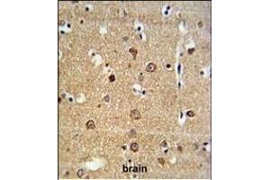 AD Antibody (Center) (ABIN653772 and ABIN2843064) IHC analysis in formalin fixed and paraffin embedded brain tissue followed by peroxidase conjugation of the secondary antibody and DAB staining. (ADAM19 抗体  (AA 207-236))