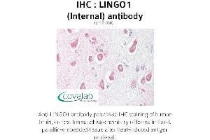Image no. 1 for anti-Leucine Rich Repeat and Ig Domain Containing 1 (LINGO1) (Internal Region) antibody (ABIN1736453) (LINGO1 抗体  (Internal Region))