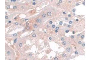 Detection of APOA1 in Human Kidney Tissue using Monoclonal Antibody to Apolipoprotein A1 (APOA1) (APOA1 抗体  (AA 122-267))