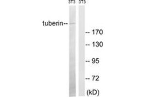 Western Blotting (WB) image for anti-Tuberous Sclerosis 2 (TSC2) (AA 947-996) antibody (ABIN2889165) (Tuberin 抗体  (AA 947-996))