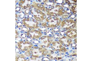Immunohistochemistry (IHC) image for anti-ARP1 Actin-Related Protein 1 Homolog B, Centractin beta (ACTR1B) (AA 1-105) antibody (ABIN7265675)