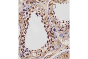 (ABIN654423 and ABIN2844158) staining IGF2BP1 in human testis tissue sections by Immunohistochemistry (IHC-P - paraformaldehyde-fixed, paraffin-embedded sections). (IGF2BP1 抗体  (C-Term))