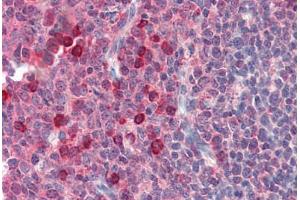 Human Tonsil (formalin-fixed, paraffin-embedded) stained with EXOC3 antibody ABIN364382 at 10 ug/ml followed by biotinylated anti-mouse IgG secondary antibody ABIN481714, alkaline phosphatase-streptavidin and chromogen. (EXOC3 抗体)