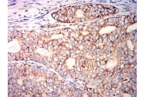 Immunohistochemistry (IHC) image for anti-Lipoprotein-Associated phospholipase A2 (Lp-PLA2) (AA 22-441) antibody (ABIN7193530)
