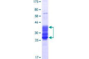 Image no. 1 for Ectodysplasin A Receptor (EDAR) (AA 27-183) protein (His-DYKDDDDK-Strep II Tag) (ABIN1352303)