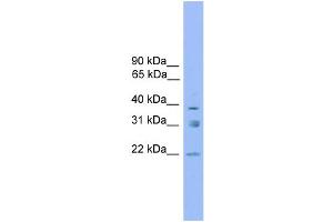 WB Suggested Anti-RNF167 Antibody Titration: 0. (RNF167 抗体  (Middle Region))