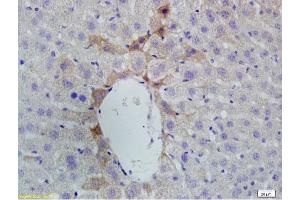 Formalin-fixed and paraffin embedded rat liver labeled with Anti-Vitamin D Receptor/VDR Polyclonal Antibody, Unconjugated (ABIN682513) at 1:200 followed by conjugation to the secondary antibody and DAB staining. (Vitamin D Receptor 抗体  (AA 65-180))